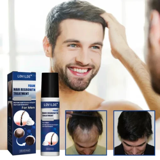 Lovilds™ Hair Growth Foam