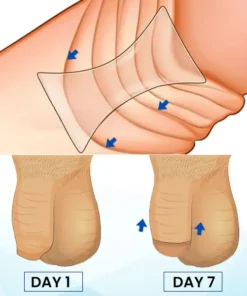 AEXZR™ Prepuce Correction Patch