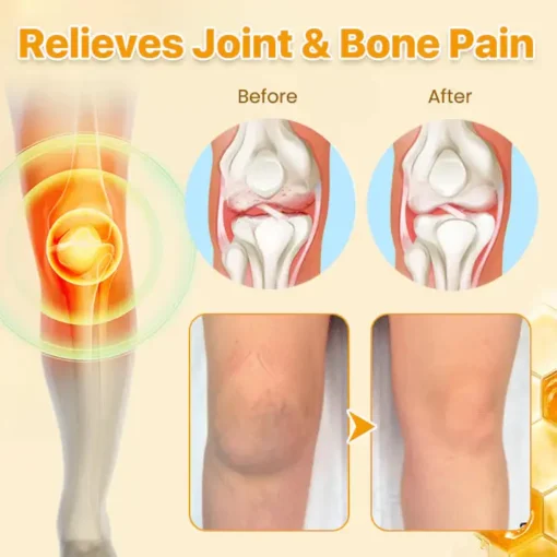 Bee Venom Cream™ for Nerve & Joint Pain Relief