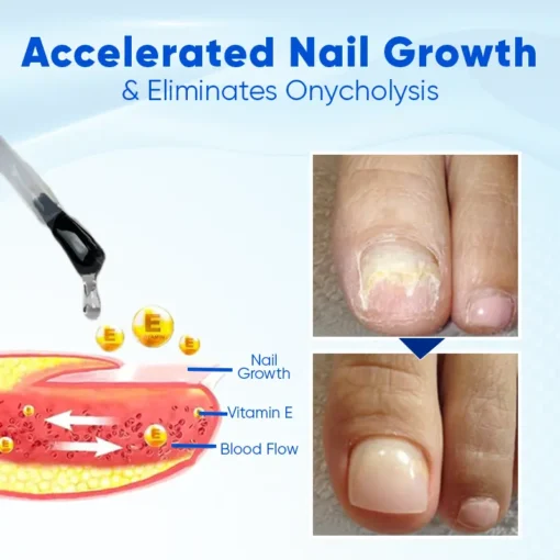 Biancat™ OnyxoGuard Nail Growth and Repair Serum