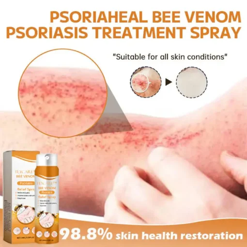 FLYCARE™ Bee Venom Psoriasis Relief Spray