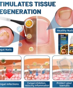 FLYCARE™ BeeVenom Nail Repair Treatment