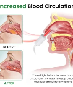 Fivfivgo™ AuraGlow Nasal LED Therapy Device