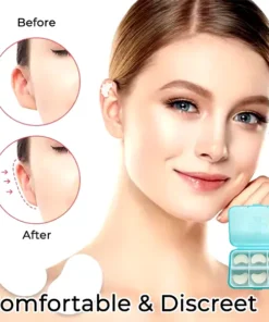 Fivfivgo™ Cosmetic Ear Corrector