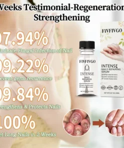 Fivfivgo™ NailGro Intense Nail Growth and Strengthening Serum