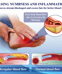 Fivfivgo™ NerveEase Ultrasonic Circulation Band