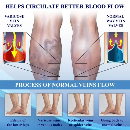 Fivfivgo™ NerveEase Ultrasonic Circulation Band