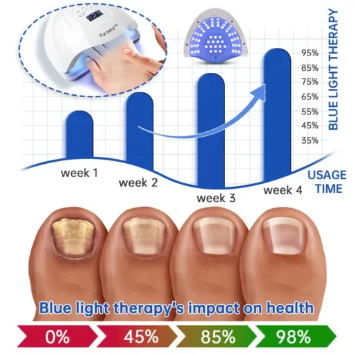 Furzero™ PureNail Fungus Laser Device