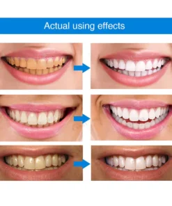 LOVILDS™ Teeth Whitening Essence