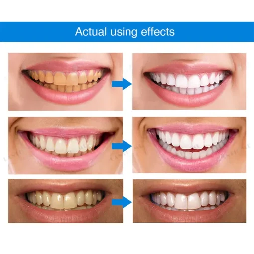 LOVILDS™ Teeth Whitening Essence