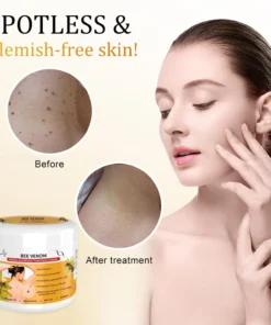 LOVILDS™Bee Venom Mole and Wart Treatment Cream