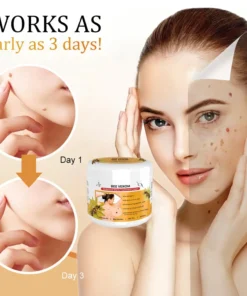 LOVILDS™Bee Venom Mole and Wart Treatment Cream