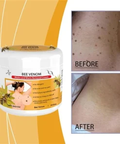 LOVILDS™Bee Venom Mole and Wart Treatment Cream