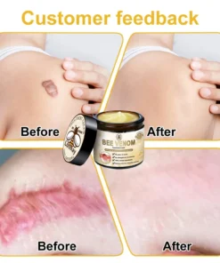 Lotmay™ Bee Venom Skin Treatment Cream