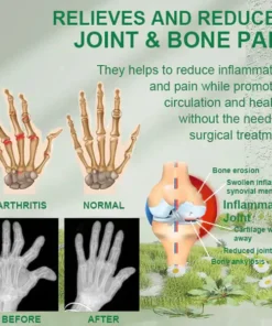 New Zealand Melittin Joint and Bone Therapy Advanced Cream