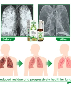 Ourlyard™ Lung Mucus cleansing Spray