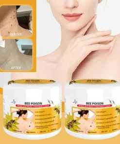 QIAWI™ BEE POSON MOLE AND WART TREATMENT CREAM