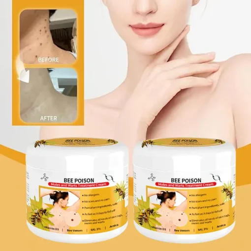 QIAWI™ BEE POSON MOLE AND WART TREATMENT CREAM