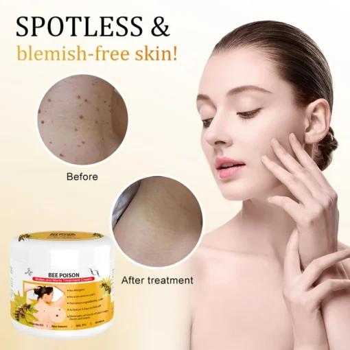 QIAWI™ BEE POSON MOLE AND WART TREATMENT CREAM