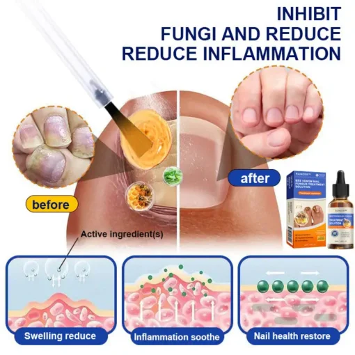 Raindew™ Bee Venom Nail Fungus Treatment Solution