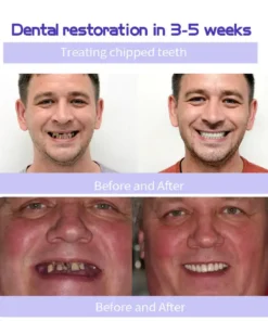 Cvreoz™ Teeth Restoration Mineral Powder