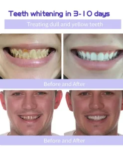 Cvreoz™ Teeth Restoration Mineral Powder