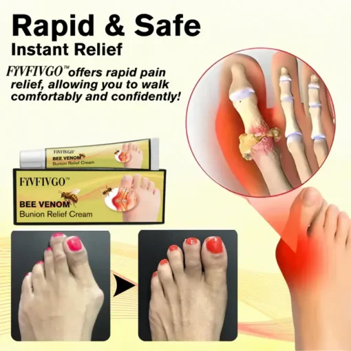 Fivfivgo™ Bee Venom Bunion Treatment Cream