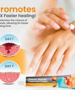 Histone™ Diabetic Wounds Treatment Cream