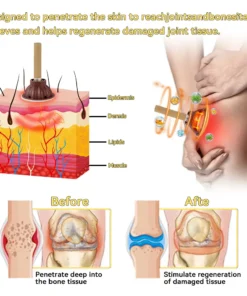 Honxi™ Bioactive Wormwood Heat Therapy Wart Removal and Weight Loss Stick