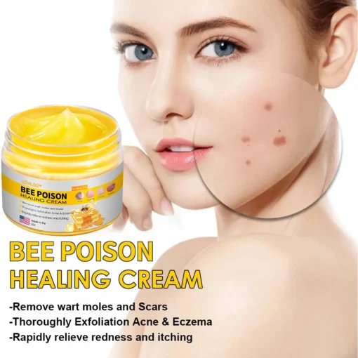 LOVILDS™ Bee Poison Skin Cream