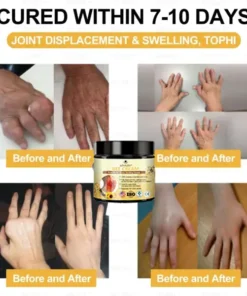 LOVILDS™ Bees Pain-Relief Bone Healing Cream