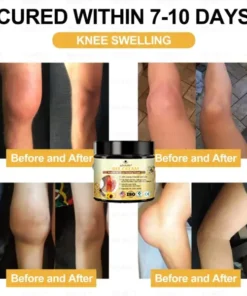 LOVILDS™ Bees Pain-Relief Bone Healing Cream