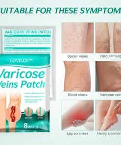 LOVILDS™ VaricoseVeins Patch