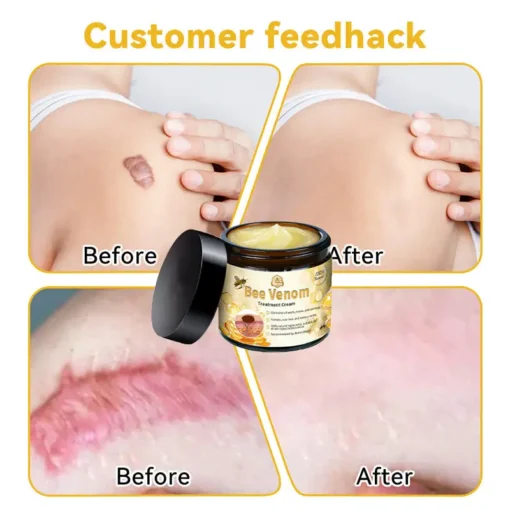 Lovilds™ Bee Venom Skin Treatment Cream