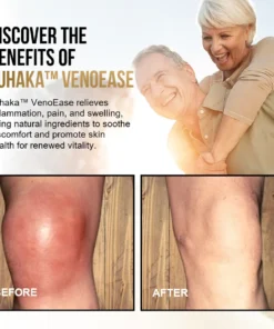 Luhaka™ VenoEase Swelling Reduction & Pain Relief Support