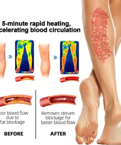 Paiduis™ Radiofrequency Herbal Thermal Knee Support