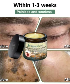 RAINDEW™ Leech Skin Treatment Cream