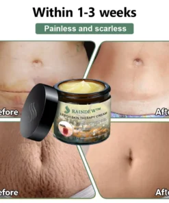 RAINDEW™ Leech Skin Treatment Cream