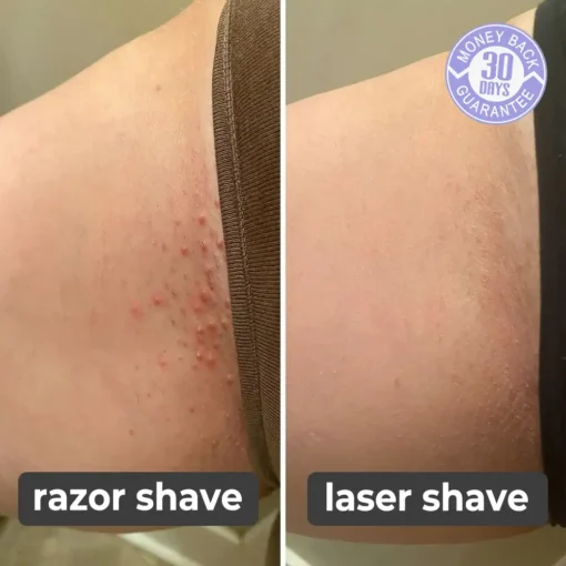 Seurico™ | Painless Facial & Body Hair Trimmer